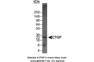 Image no. 1 for anti-Connective Tissue Growth Factor (CTGF) (C-Term) antibody (ABIN363491) (CTGF 抗体  (C-Term))
