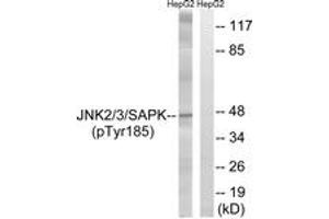 Western blot analysis of extracts from HepG2 cells treated with nocodazole 1ug/ml 16h, using SAPK/JNK (Phospho-Tyr185) Antibody. (SAPK, JNK (AA 151-200), (pTyr185) 抗体)