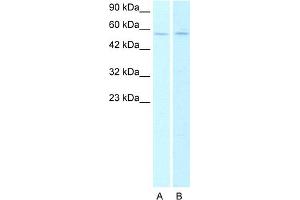 Host:  Rabbit   Target Name:  CHRNA2 Lane A: HepG2 cell lysates Lane B: Raji cell lysates   Antibody Dilution:   0. (CHRNA2 抗体  (N-Term))