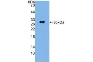 Detection of Recombinant ADCY1, Human using Polyclonal Antibody to Adenylate Cyclase 1, Brain (ADCY1) (ADCY1 抗体  (AA 835-1061))