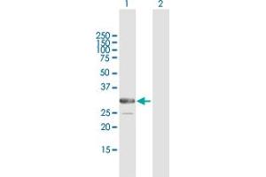 Western Blot analysis of ARMC10 expression in transfected 293T cell line by ARMC10 MaxPab polyclonal antibody. (ARMC10 抗体  (AA 1-308))
