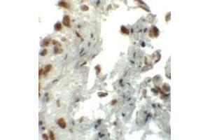 Immunohistochemical staining of human lung cells with EZH1 polyclonal antibody  at 5 ug/mL. (EZH1 抗体  (N-Term))