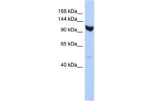 ARMC3 antibody used at 1 ug/ml to detect target protein. (ARMC3 抗体  (Middle Region))