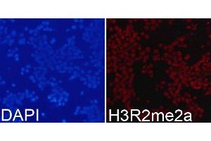 Immunofluorescence analysis of 293T cells using Asymmetric DiMethyl-Histone H3-R2 antibody. (Histone 3 抗体  (H3R2me2))