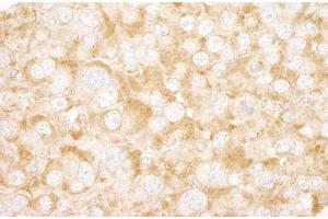 Immunohistochemistry (IHC) image for anti-UV Radiation Resistance Associated Gene (UVRAG) (AA 649-699) antibody (ABIN7448857)