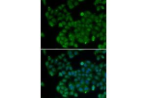 Immunofluorescence analysis of U20S cell using DNMT3L antibody. (DNMT3L 抗体)