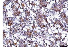 IHC analysis of MCM6 using anti-MCM6 antibody (ABIN7600035). (MCM6 抗体  (AA 14-821))