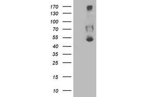 Western Blotting (WB) image for anti-Sedoheptulokinase (SHPK) antibody (ABIN1500923) (SHPK 抗体)