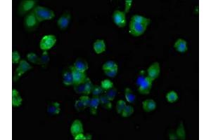 Immunofluorescent analysis of HepG2 cells using ABIN7153179 at dilution of 1:100 and Alexa Fluor 488-congugated AffiniPure Goat Anti-Rabbit IgG(H+L) (FZD1 抗体  (AA 125-225))