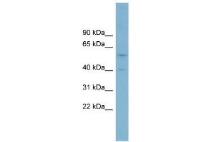 WB Suggested Anti-SUSD4 Antibody Titration:  0. (SUSD4 抗体  (Middle Region))