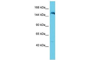 Host: Rabbit Target Name: ANKRD36B Sample Type: 721_B Whole Cell lysates Antibody Dilution: 1. (ANKRD36B 抗体  (C-Term))
