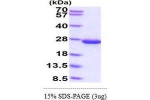 SDS-PAGE (SDS) image for Diazepam Binding Inhibitor (DBI) (AA 1-87) protein (His tag) (ABIN5855101) (Diazepam Binding Inhibitor Protein (DBI) (AA 1-87) (His tag))