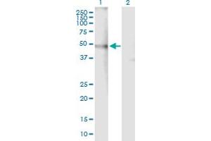 Western Blot analysis of CHRNA4 expression in transfected 293T cell line by CHRNA4 MaxPab polyclonal antibody. (CHRNA4 抗体  (AA 1-451))