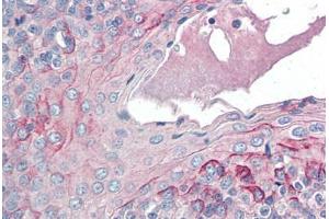 Human Tonsil (formalin-fixed, paraffin-embedded) stained with CCR6 antibody ABIN337207 at 5 ug/ml followed by biotinylated anti-goat IgG secondary antibody ABIN481715, alkaline phosphatase-streptavidin and chromogen. (CCR6 抗体  (AA 18-46))
