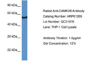 Western Blotting (WB) image for anti-Calcium/calmodulin-Dependent Protein Kinase II beta (CAMK2B) (Middle Region) antibody (ABIN2788743) (CAMK2B 抗体  (Middle Region))
