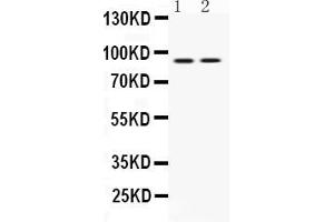 Western blot analysis of UHRF1 expression in MCF-7 whole cell lysates ( Lane 1) and U2OS whole cell lysates ( Lane 2). (UHRF1 抗体  (N-Term))