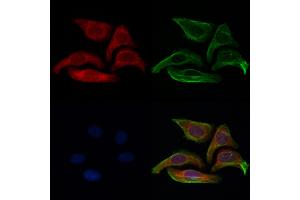 ABIN6261614 and ABIN6273044 staining Hela cells by IF/ICC. (ETFB 抗体  (Internal Region))