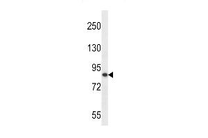 Western blot analysis in MDA-MB453 cell line lysates (35ug/lane). (OTUD7B 抗体  (C-Term))