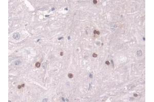Immunohistochemistry (IHC) image for anti-Transketolase (TKT) (AA 1-286) antibody (ABIN7441421)