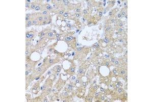 Immunohistochemistry of paraffin-embedded human liver injury using TUBGCP3 antibody. (TUBGCP3 抗体  (AA 1-250))