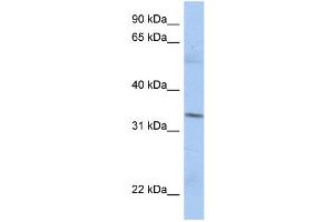 WB Suggested Anti-MRPL15 Antibody Titration:  0. (MRPL15 抗体  (N-Term))