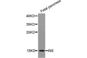 Western Blotting (WB) image for anti-Insulin (INS) (AA 1-110) antibody (ABIN6219279) (Insulin 抗体  (AA 1-110))