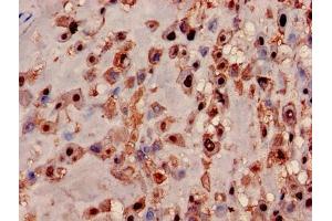Immunohistochemistry of paraffin-embedded human placenta tissue using ABIN7142365 at dilution of 1:100 (MRPL19 抗体  (AA 1-292))