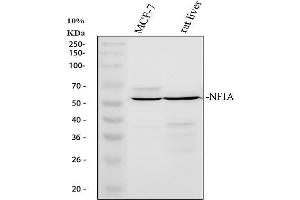 Western blot analysis of NFIA using anti-NFIA antibody (ABIN4886680). (NFIA 抗体  (Middle Region))