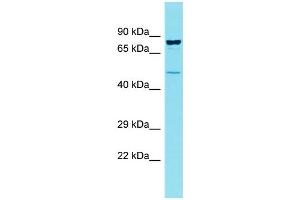 Host: Rabbit Target Name: CCDC121 Sample Type: OVCAR-3 Whole Cell lysates Antibody Dilution: 1. (CCDC121 抗体  (Middle Region))