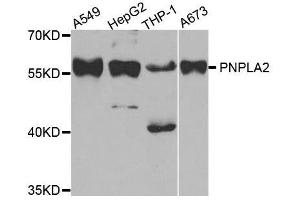 Western blot analysis of extracts of various cell lines, using PNPLA2 antibody. (PNPLA2 抗体  (AA 265-504))