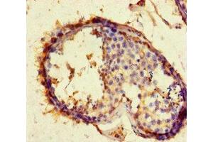 Immunohistochemistry of paraffin-embedded human testis tissue using ABIN7144126 at dilution of 1:100 (ACE2 抗体  (AA 395-638))