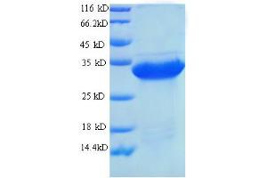 Urate Oxidase (UOX) (AA 11-297) protein (His tag) (Urate Oxidase Protein (UOX) (AA 11-297) (His tag))