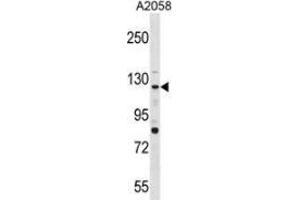 Western blot analysis in A2058 cell line lysates (35ug/lane) using PTPRN2  Antibody . (PTPRN2 抗体  (N-Term))