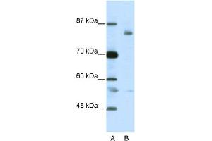 WB Suggested Anti-LZTR1 Antibody Titration:  2. (LZTR1 抗体  (C-Term))