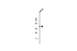 Anti-PIM1 Antibody  at 1:1000 dilution + Jurkat whole cell lysate Lysates/proteins at 20 μg per lane. (PIM1 抗体  (C-Term))