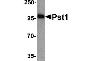 Western blot analysis of TM yeast Pst1 protein (50 ng) with Pst1 antibody at 1 µg/mL. (ST8SIA4 抗体  (N-Term))