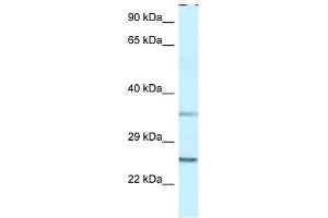 anti-Protein Phosphatase 1, Regulatory (Inhibitor) Subunit 2 (PPP1R2) (N-Term) antibody