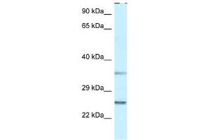 Western Blot showing PPP1R2 antibody used at a concentration of 1 ug/ml against THP-1 Cell Lysate (PPP1R2 抗体  (N-Term))