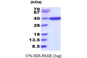 SDS-PAGE (SDS) image for Dihydrodiol Dehydrogenase (DDH) (AA 1-323) (Active) protein (ABIN6387732)