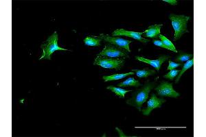 Immunofluorescence of purified MaxPab antibody to CD44 on HeLa cell. (CD44 抗体  (AA 1-361))