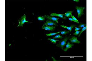 Immunofluorescence (IF) image for anti-CD44 (CD44) (AA 1-361) antibody (ABIN514203)