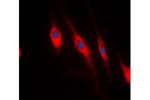Immunofluorescent analysis of PDLIM1 staining in HeLa cells. (PDLIM1 抗体  (Center))