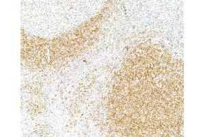 Immunohistochemistry (IHC) image for anti-B-cell antigen receptor complex-associated protein alpha chain (CD79A) (AA 176-226) antibody (ABIN7454005) (Recombinant CD79a 抗体  (AA 176-226))