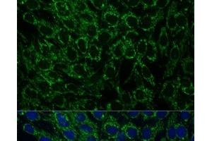 Immunofluorescence analysis of C6 cells using MTIF2 Polyclonal Antibody at dilution of 1:100 (40x lens). (MTIF2 抗体)