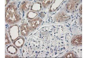 Immunohistochemical staining of paraffin-embedded Human Kidney tissue using anti-NIF3L1 mouse monoclonal antibody. (NIF3L1 抗体)