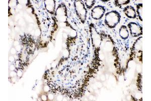Immunohistochemistry (IHC) image for anti-Minichromosome Maintenance Complex Component 3 (MCM3) (AA 13-27), (N-Term) antibody (ABIN3044243)