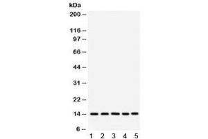 Western blot testing of 1) rat liver, 2) mouse liver, 3) human SMMC, 4) HepG2 and 5) RH35 lysate with FABP antibody. (FABP1 (liver) 抗体)