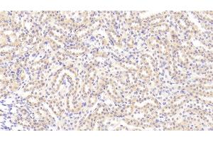 Detection of TL1A in Rat Kidney Tissue using Polyclonal Antibody to TNF Like Ligand 1A (TL1A) (TNF Like Ligand 1A (AA 70-230) 抗体)