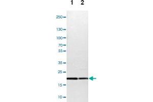 Western blot analysis of Lane 1: NIH-3T3 cell lysate (Mouse embryonic fibroblast cells), Lane 2: NBT-II cell lysate (Rat Wistar bladder tumour cells) with TOMM22 polyclonal antibody  at 1:100-1:500 dilution. (TOMM22 抗体)
