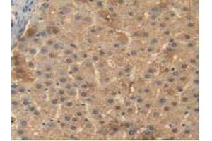 IHC-P analysis of Human Liver Tissue, with DAB staining. (BMP4 抗体  (AA 22-408))
